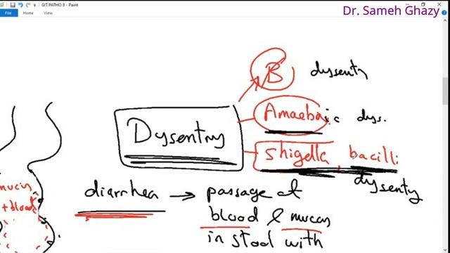 Systemic pathology 29 : GIT 6 ( inflammations of intestine ) DR.SAMEH GHAZY смотреть онлайн