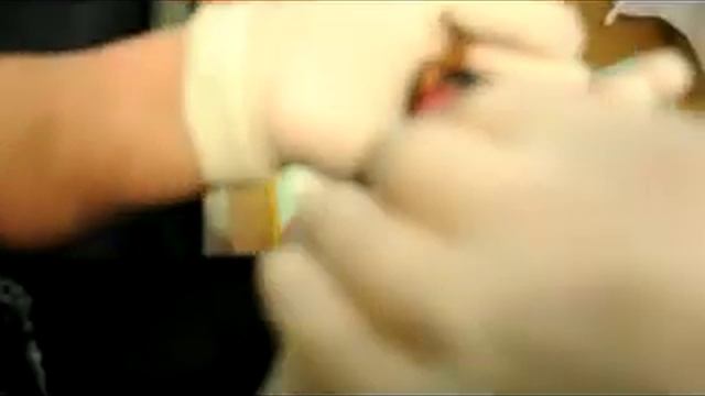 Роды йорка часть_2 смотреть онлайн