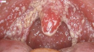 ЧТО БУДЕТ, ЕСЛИ ВЫПИТЬ УКСУС?