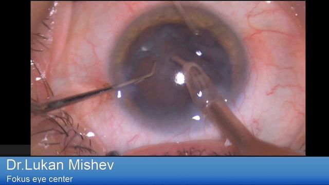 Lentis Comfort Lukan Mishev Live Stream смотреть онлайн