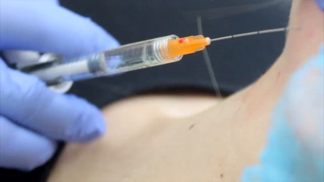 Моделирование овала и подбородочной области лица смотреть онлайн