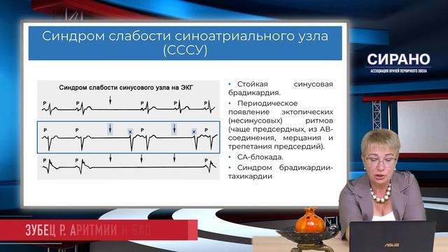 6.11.2021 16:30 ЭКГ: зубец Р смотреть онлайн