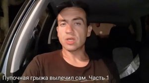 Пупочная грыжа вылечил сам. Часть 1