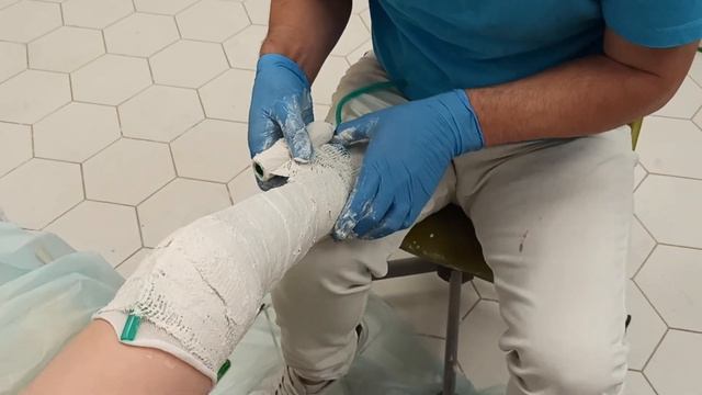 Изготавливаем ортезы\\Сняли слепки\\ смотреть онлайн