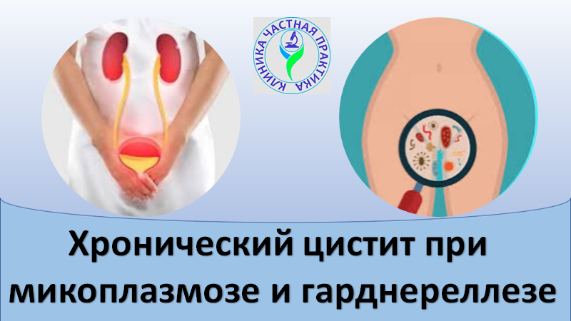 Хронический цистит при микоплазмозе и гарднереллезе смотреть онлайн