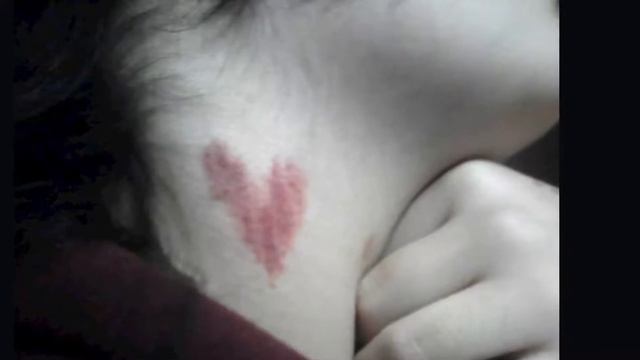 Любовная метка 6 способов избавиться от засоса очень быстро смотреть онлайн