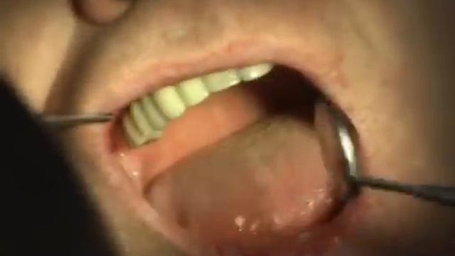 Импластрукция-видеолекция смотреть онлайн