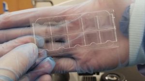 Анализ мочи по Нечипоренко как собрать