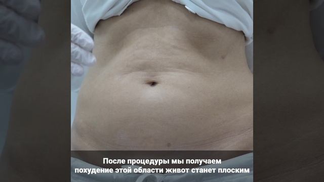 Живот смотреть онлайн