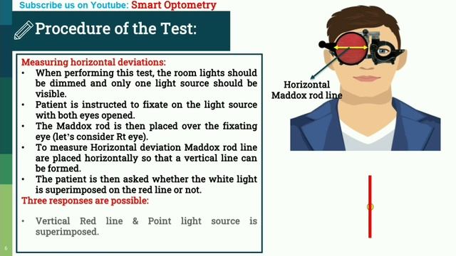 Maddox Rod Test- A Complete Tutorial смотреть онлайн