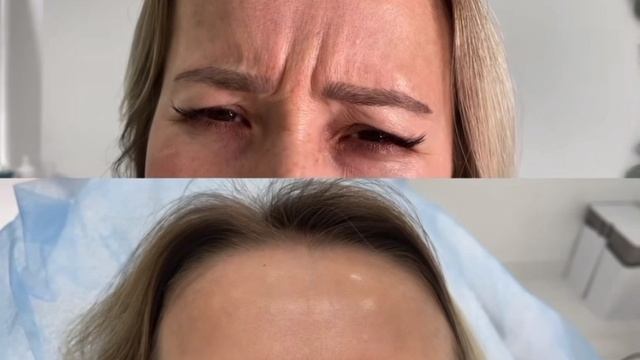 Ботокс смотреть онлайн