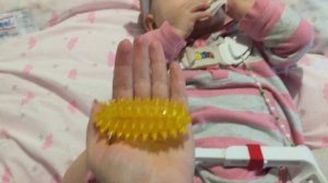 Дисплазия тазобедренного сустава, ортез Тюбингера, врожденный вывих бедра. Шина Кошля.