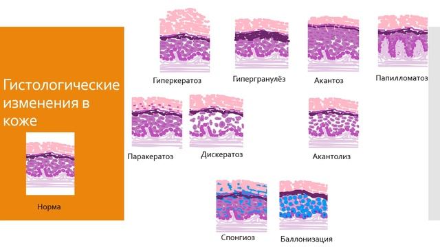 Дерматология 2. Основные элементы поражения кожи в дерматологии