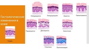 Дерматология 2. Основные элементы поражения кожи в дерматологии