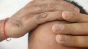 Финастерид: мои результаты 4х месяцев