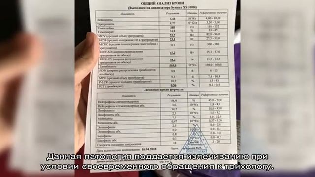 Сделайте свои глаза ярче с ресницами