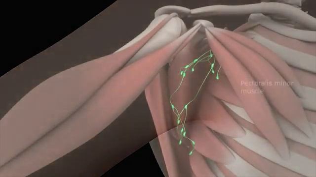Axillary Anatomy: 3D Animation of Axillary Lymph Node Dissection Procedure Part - 1 смотреть онлайн
