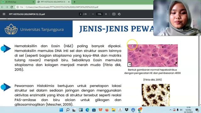 Persentasi Histologi Menggunakan Aplikasi Screen Pal смотреть онлайн