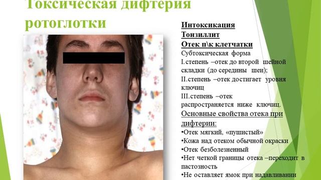 Дифтерия смотреть онлайн