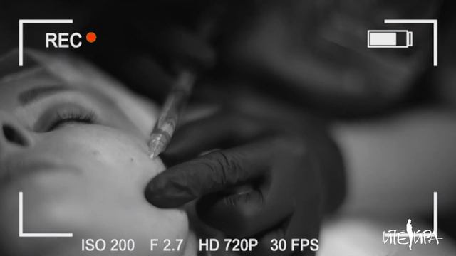 Beauty-техосмотр Натали (часть2): 3D лифтинг смотреть онлайн