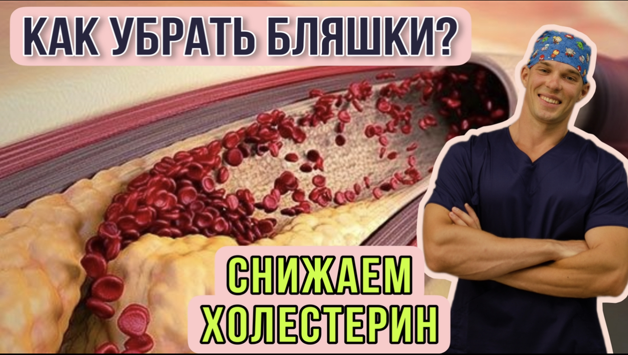 Как снизить ХОЛЕСТЕРИН? Бляшки в сосудах - как их почистить? Инфаркт, инсульт, кээ, стентирование смотреть онлайн
