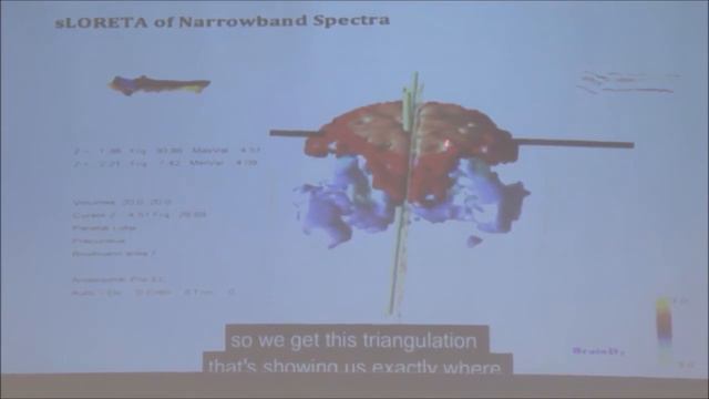 Исследования  Аксесс Барc, Энцефалограмма головного мозга До и После сессии