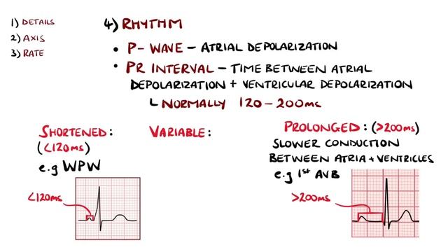 ECG Interpretation Made Easy (Learn How To Interpret An ECG In 13 Minutes)