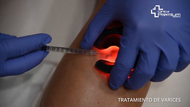 Los tratamientos de varices de última generación contados por el Dr. Javier Pérez смотреть онлайн