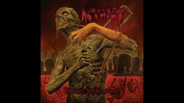 Autopsy - Autopsy