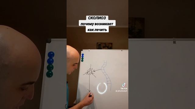 СКОЛИОЗ ПОЧЕМУ возникает КАК лечить смотреть онлайн