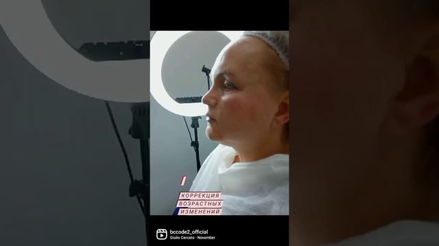 Коррекция возрастных изменений/Москва смотреть онлайн