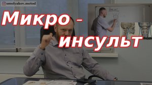 Микроинсульт симптомы, признаки у женщин и мужчин