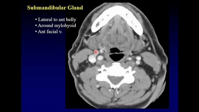 SALIVARY GLANDS: CT ANATOMY TIPS by Dr Barton Branstetter смотреть онлайн