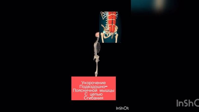 Техника растяжения поясничной мышцы в положении пациента лежа на боку смотреть онлайн