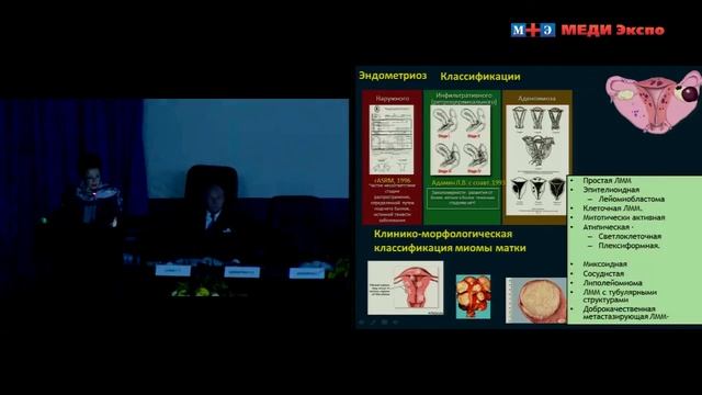 Лекция "Миома матки и генитальный эндометриоз - ключевые проблемы современной гинекологии смотреть онлайн