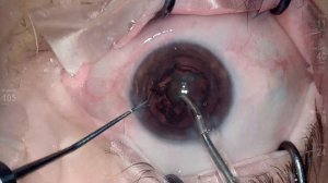 Anton Angelov Vista Live Stream