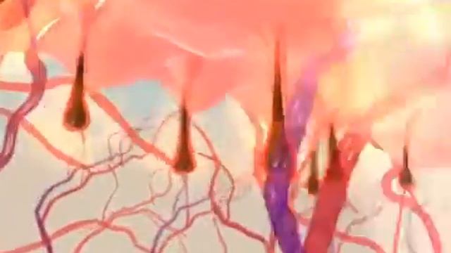 What is SHR Hair Removal? смотреть онлайн