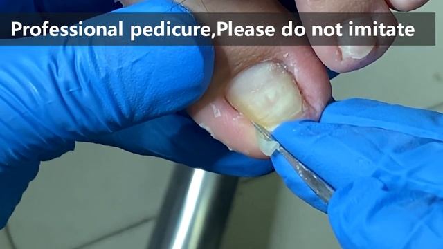 Pedicure Tutorial ：Treat Extra Long Toenails【Xue Yidao】