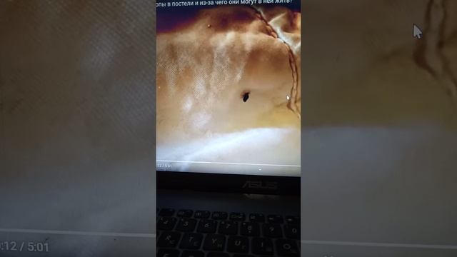 Клопы!!!!! как избавиться дешёвым и эффективным способом,а главное безопасным! смотреть онлайн