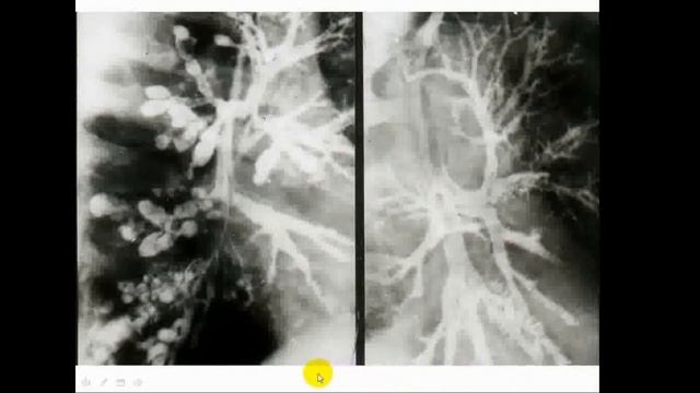 08:00-09:30 Лучевая диагностика, методы лучевого исследования смотреть онлайн