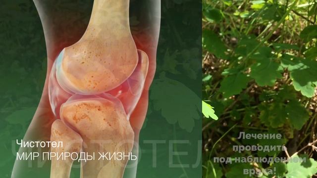 Чистотел- лекарство от ста болезней. Бородавник, желтушник, золотая трава в народной медицине смотреть онлайн