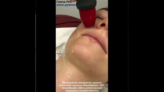 ShockMaster (Шокмастер) 300, 500. Ударно-волновая терапия (УВТ) в косметологии. смотреть онлайн