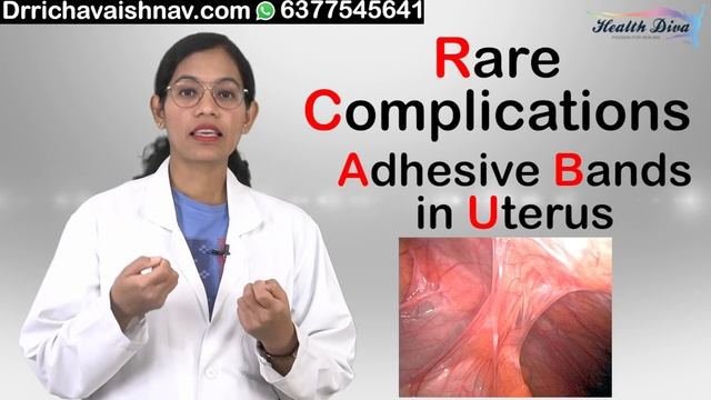 Dilation and curettage# D &C #Do's & Dont's after D&C #D&E FAQs смотреть онлайн