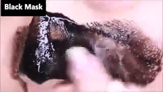 Как Быстро Избавиться От Черных Точек! 100% Избавление - Не Могу Избавиться От Черных Точек смотреть онлайн