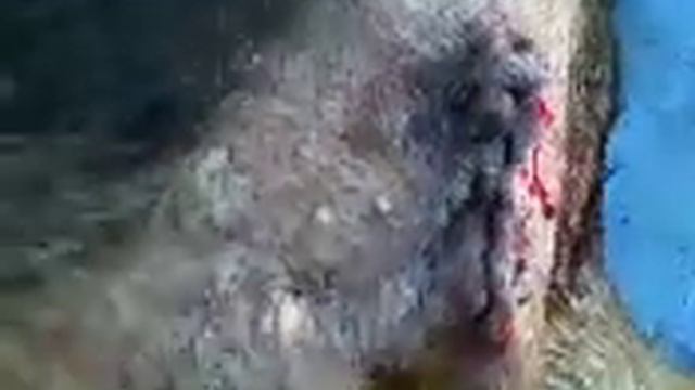 Extraccion de Mioma 2 смотреть онлайн