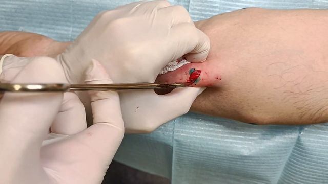 Массаж бутылочками