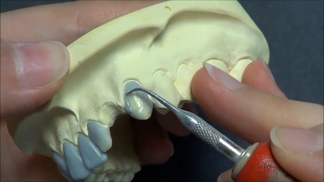 Моделирование фронтального моста(Live wax up lower anterior bridge) смотреть онлайн