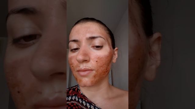 Лазерная шлифовка лица смотреть онлайн