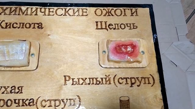 Химические ожоги смотреть онлайн