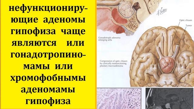 2 лекция Гипоталамус Гипофиз смотреть онлайн